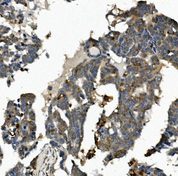 Anti-ME2 Antibody