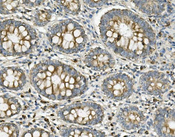 Anti-ME2 Antibody