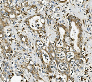 Anti-ME2 Antibody