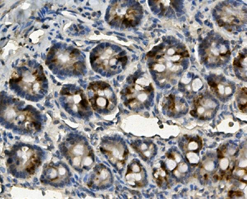 Anti-ME2 Antibody