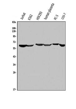 Anti-ME2 Antibody