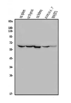 Anti-ME2 Antibody