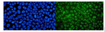 Anti-MED4 Antibody