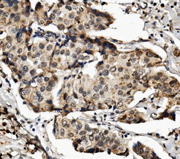 Anti-MED4 Antibody