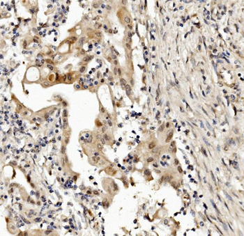 Anti-MED4 Antibody