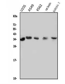 Anti-MED4 Antibody
