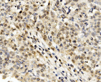 Anti-MNT Antibody