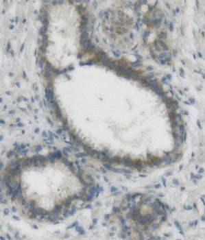 Nectin 2/NECTIN2 Antibody