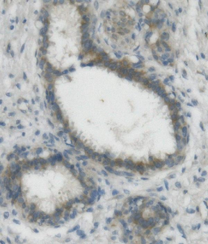Anti-Nectin 2/NECTIN2 Antibody