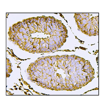Anti-Nectin 2/NECTIN2 Antibody