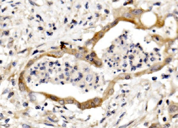 Anti-Nectin 3/NECTIN3 Antibody