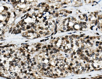 Anti-NFIC/CTF Antibody