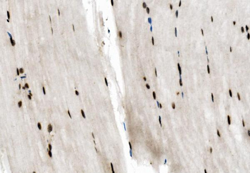 Anti-NFIC/CTF Antibody
