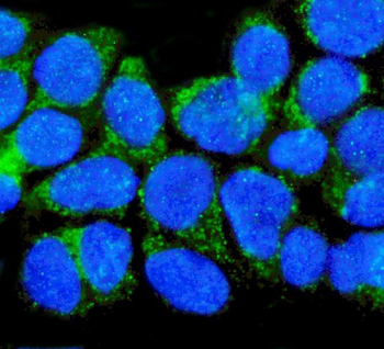 Anti-p75 NGF Receptor/NGFR Antibody