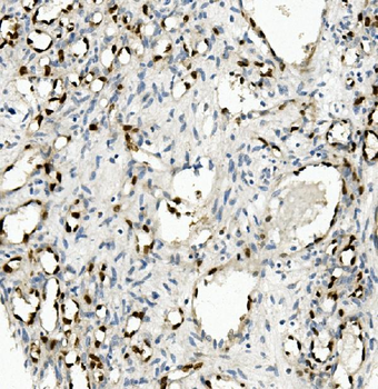 Anti-NOVA2 Antibody