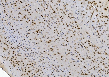 Anti-NOVA2 Antibody