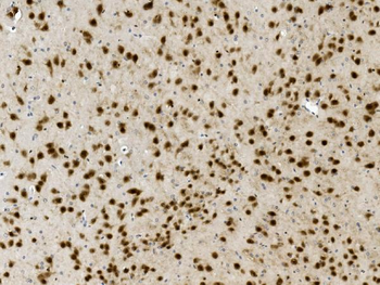 Anti-NOVA2 Antibody