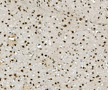 Anti-NOVA2 Antibody