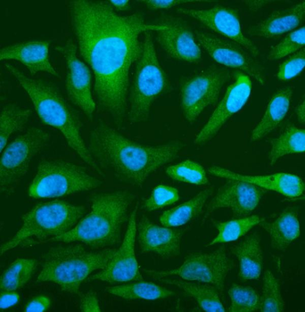 Anti-OAS3 Antibody