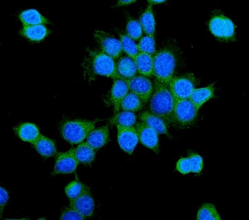 Anti-PCK2 Antibody