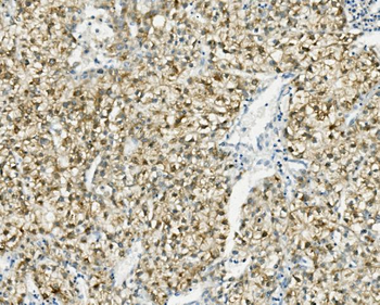 Anti-PCK2 Antibody