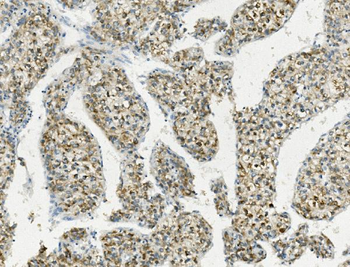 Anti-PCK2 Antibody