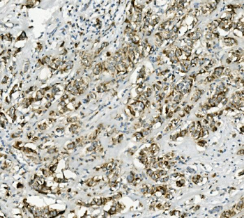 Anti-PCK2 Antibody