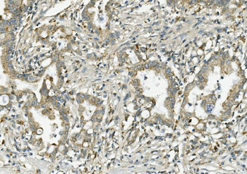 Anti-PCK2 Antibody