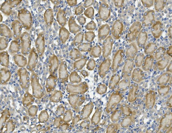 Anti-PCK2 Antibody