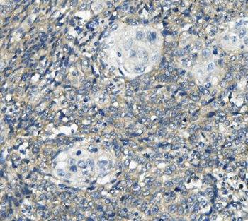 Anti-PHEX Antibody