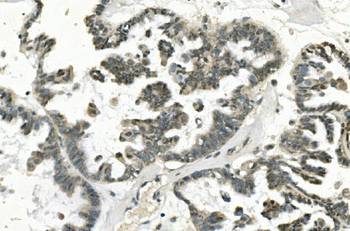 Anti-PHEX Antibody