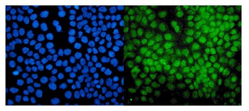 Anti-E3 SUMO-protein ligase PIAS1 PIAS1 Antibody