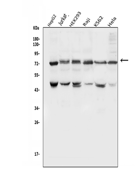 Anti-E3 SUMO-protein ligase PIAS1 PIAS1 Antibody