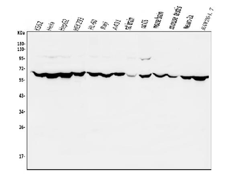 Anti-PIAS2 Antibody