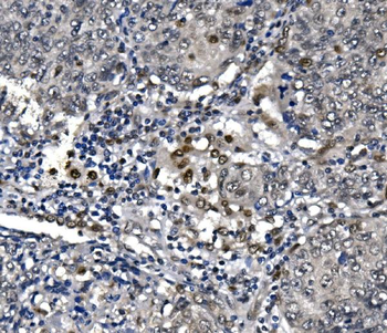 Anti-RNA polymerase II/POLR2A Antibody