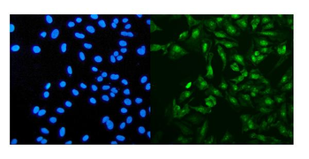 Anti-PRDM5 Antibody