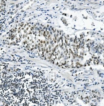 Anti-PRDM5 Antibody