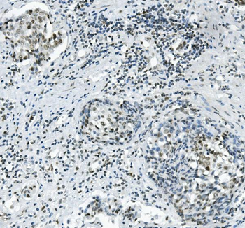 Anti-PRDM5 Antibody
