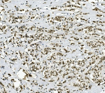 Anti-PRDM5 Antibody