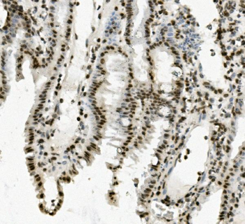 Anti-PRDM5 Antibody