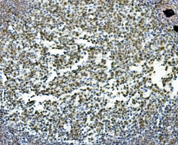 Anti-PRDM5 Antibody