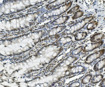 Anti-PRDM5 Antibody