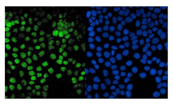 Anti-PTF1A Antibody