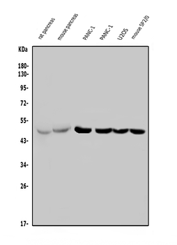 Anti-PTF1A Antibody