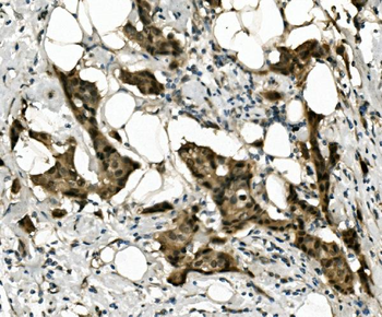 Anti-RBPMS Antibody