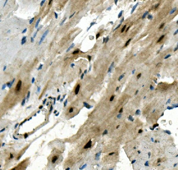 Anti-RBPMS Antibody