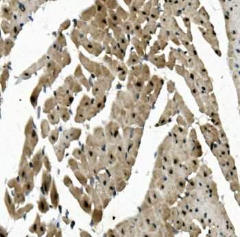 Anti-RBPMS Antibody