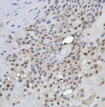 Anti-REC8 Antibody