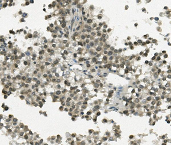 Anti-REC8 Antibody