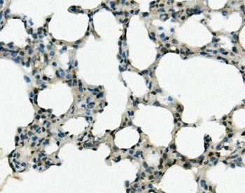 Anti-REC8 Antibody